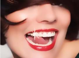 Amazing Hollywood Smile